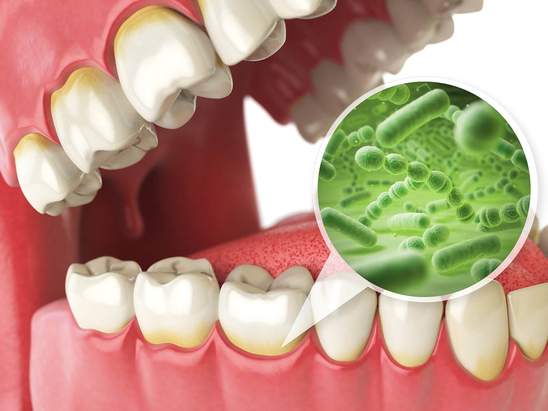 Cât timp până când o infecție dentară te poate ucide?