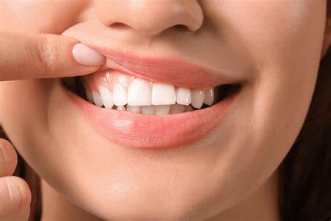 Cea mai bună Periuță de dinți electrică pentru retragerea gingiilor