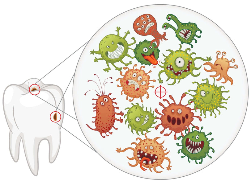 Cât timp poate rămâne netratată o infecție dentară?