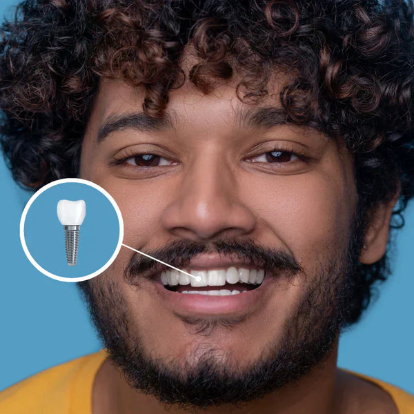 De ce să nu consumi lactate după un implant dentar?