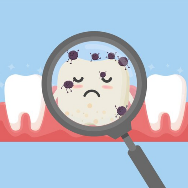 Cel mai puternic antibiotic natural pentru infecția dentară: remedii eficiente și prevenție