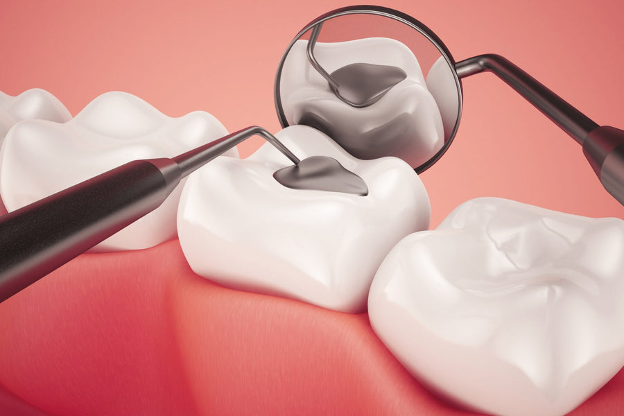 De ce mă doare plomba dentară după luni?